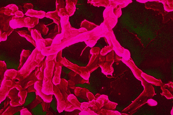 desinfeccion-bacterias2